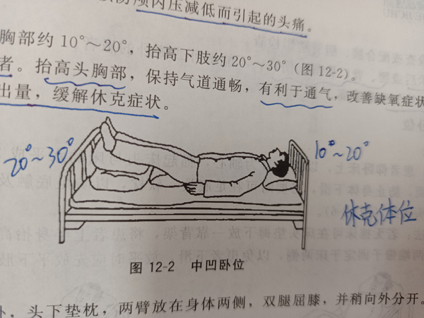 大S為何常臥？深度剖析其背后的多重原因與健康管理之道